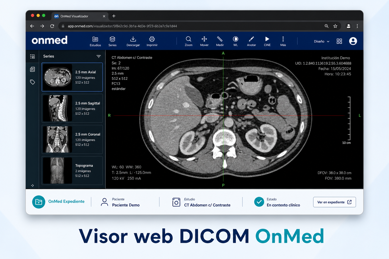 Visor web DICOM OnMed con series de CT y contexto clínico de OnMed Expediente
